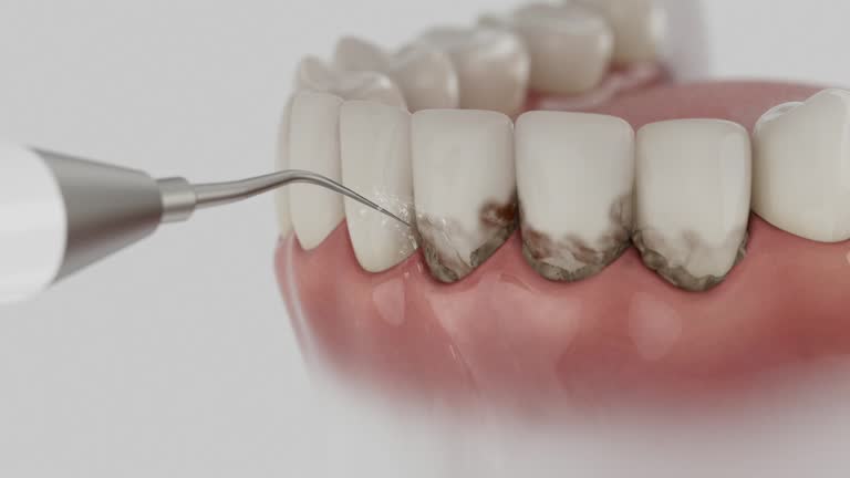 Trusted Dental Crowns And Bridges service in Drumright, OK - Dentist Open Now